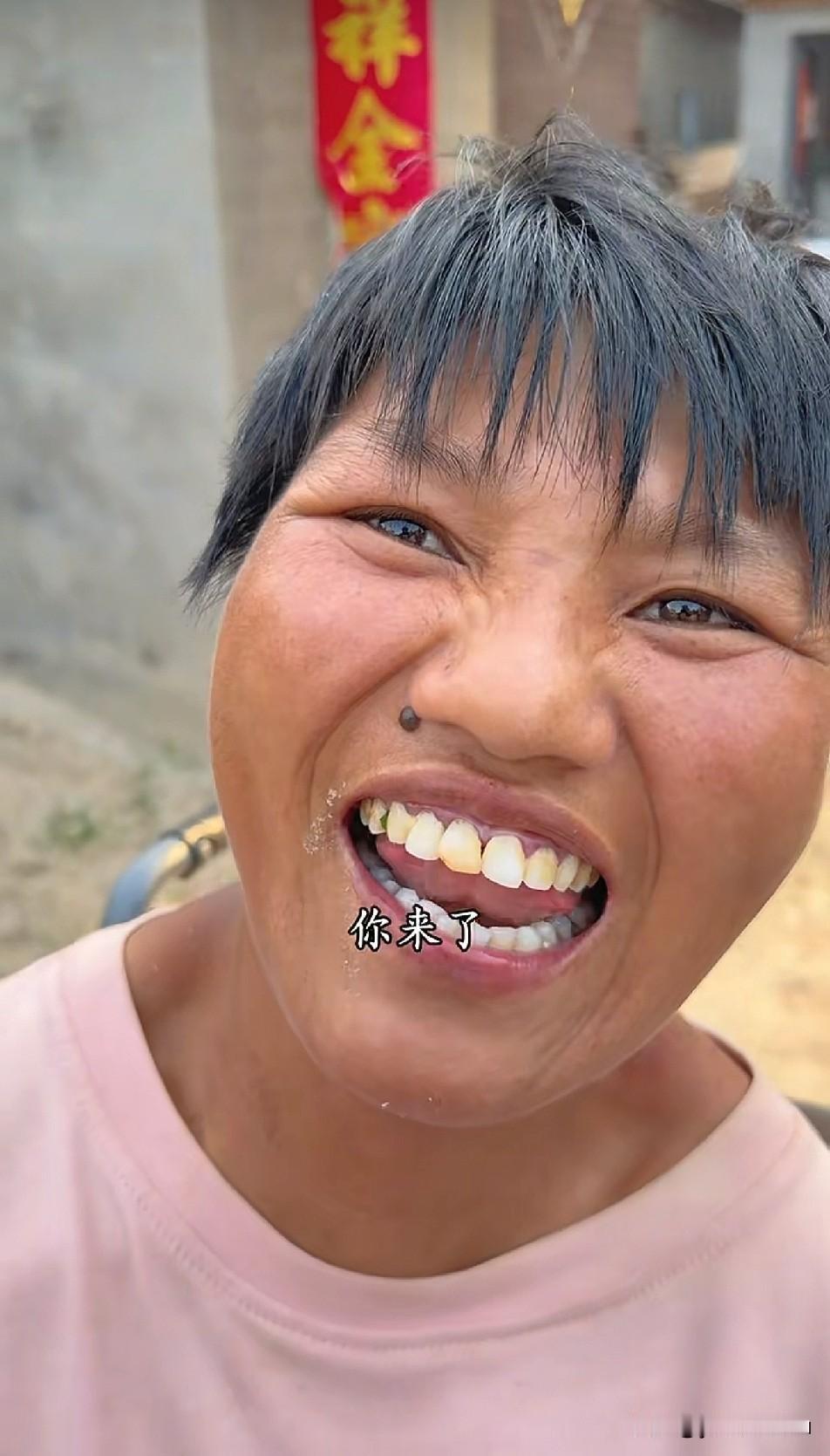 妮娃你别离小徐那么进，隔着镜头看都吓人，那牙齿黄的黑的绿的