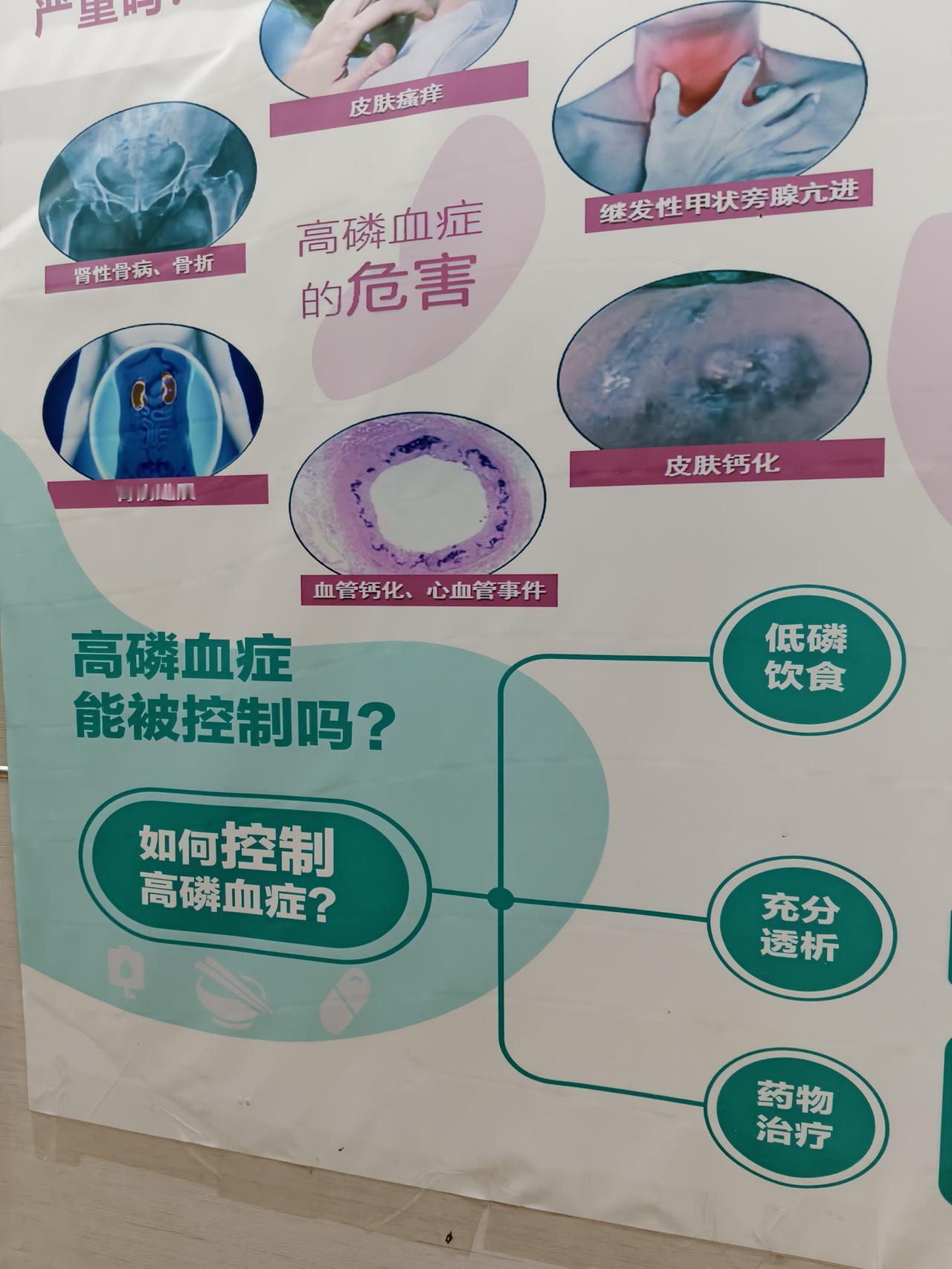 我的一个疏忽不在意，把我原来的痛风漫延到了，现在的肾慢性病，说真的，此时此刻的我
