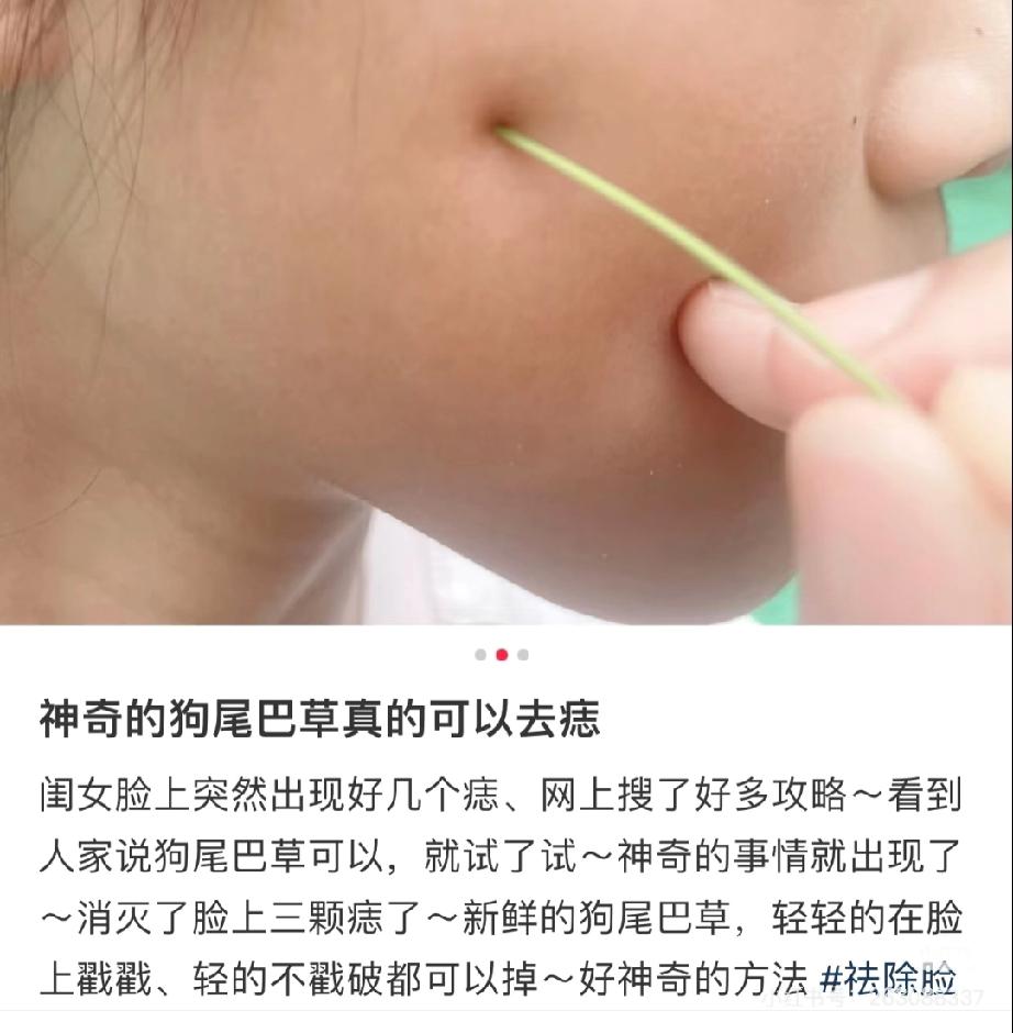 民间偏方，有时候真的不可信！

最近下巴上无意间长了一颗黑痣，我想着能不能不花钱