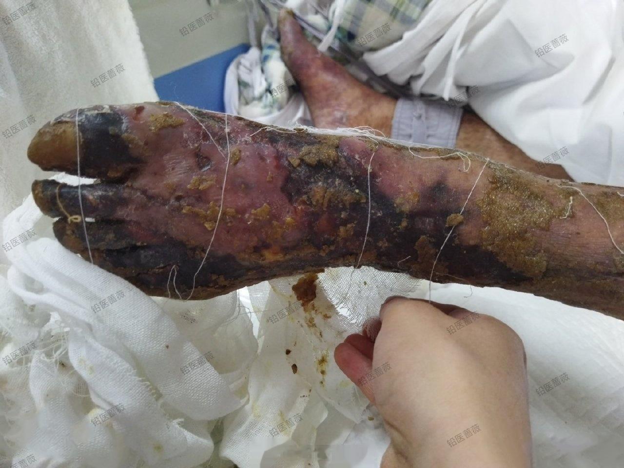 欣赏一下这只腌入味的脚…