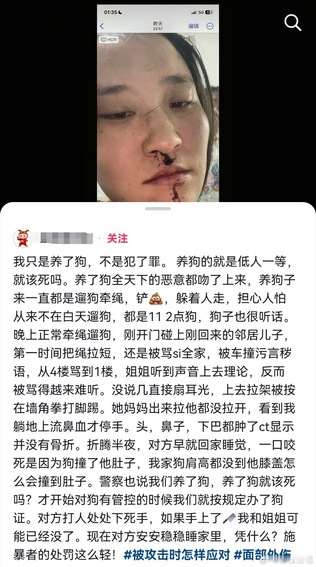 你养狗一直拴绳、铲屎、躲着人走……你是全天下最文明的养狗人！然后，别人突然冲上来