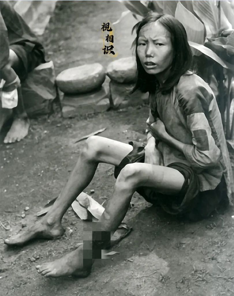 1946年，湖南衡阳，一名饥肠辘辘的女孩坐在地上，她的年龄不大，但是瘦成了皮包骨...
