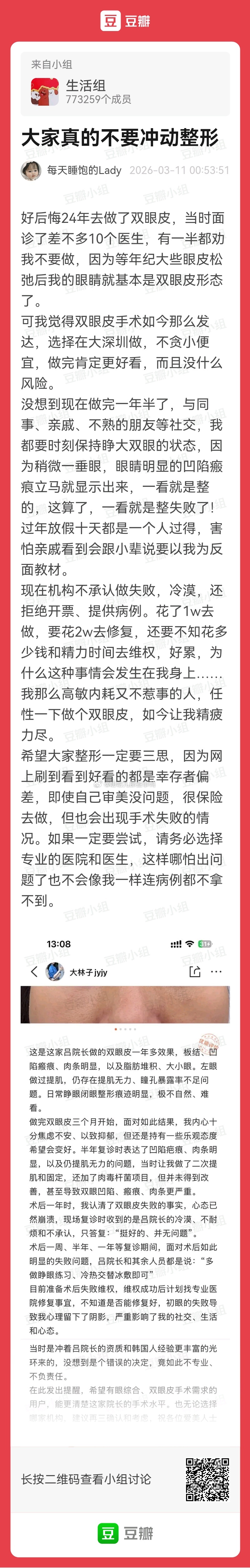 大家不要冲动整形！！