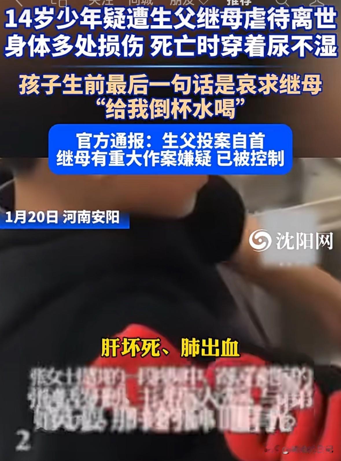 最新报道，一个14岁男孩儿，长期遭受父亲和继母虐待致s，据说，男孩儿最后瘦的肚子