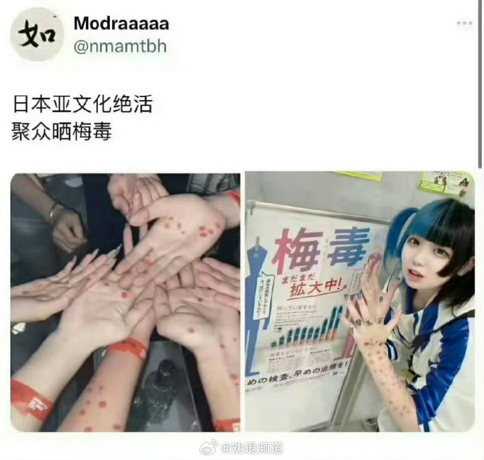 日本治梅毒的药不够了日本现在都开始流行梅毒妆了...真正恐怖的是会有人因为这种妆