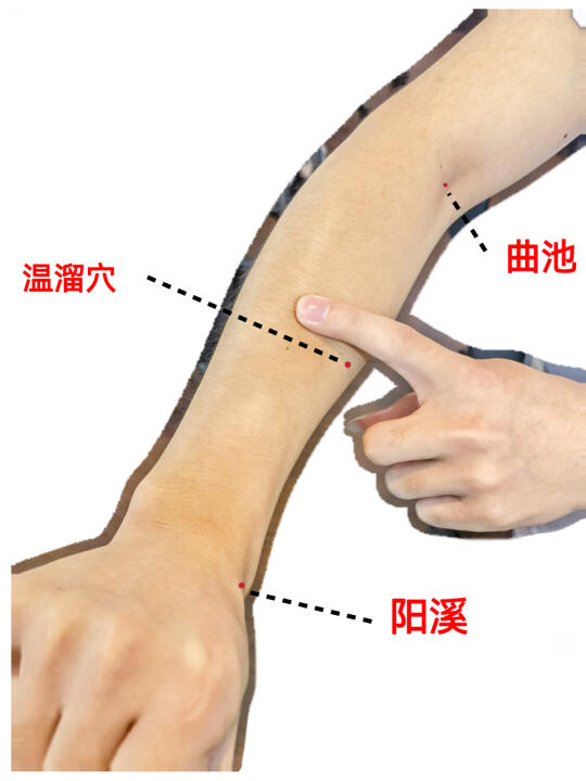 肌瘤，帮一个是一个了‼️