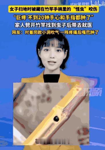 万万没想到！四川雅安，一位女子在家里扫地时，竟被扫把柄里窜出的一只“怪虫”狠狠咬