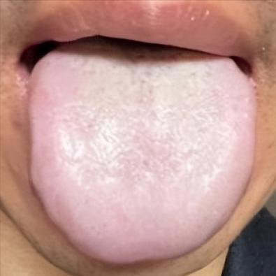 老中医提醒：这种舌象别乱清热祛湿！越祛越虚，找准根源几十元就能调！

日常很多人