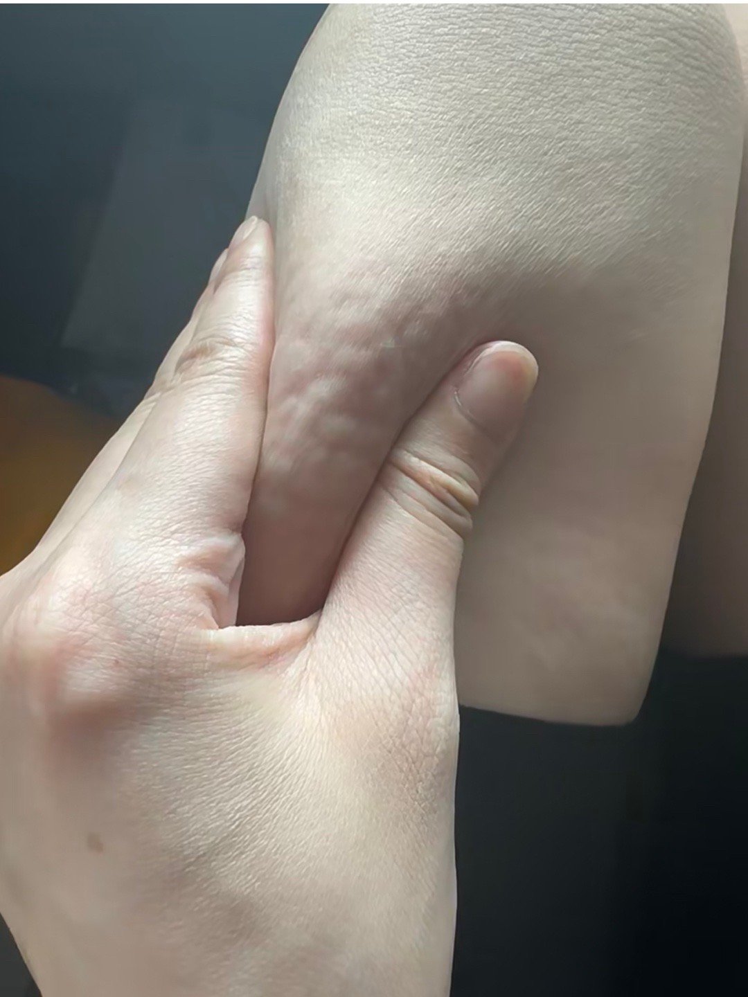 原来掐大腿能看到自己的脂肪 ​​​