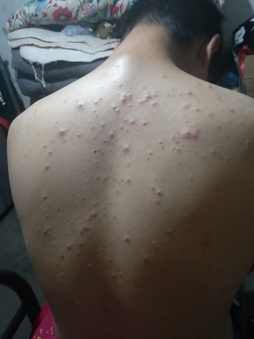 网友投稿： 帮他支个招 他比较怕热   天气一热就这样  😰 ​​​