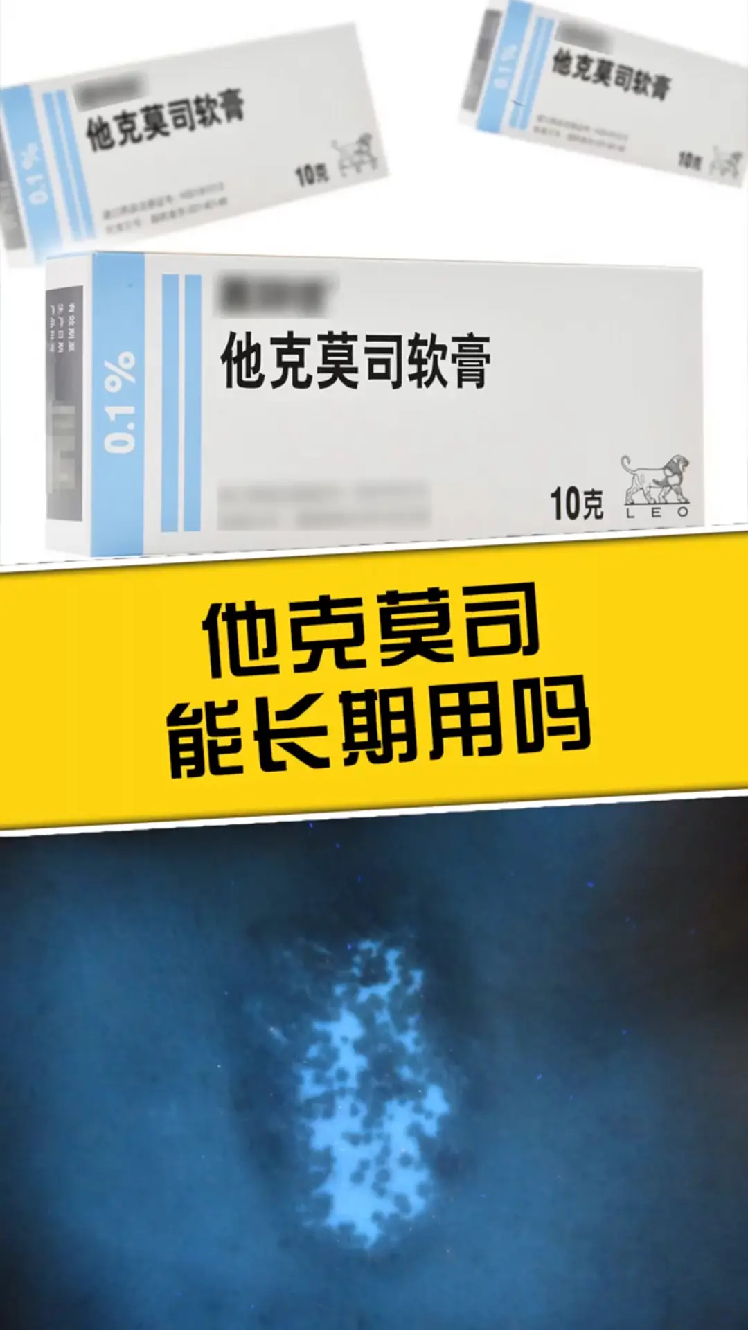 以下是关于长期使用他克莫司软膏的关键信息： 1、使用时间：他克莫司软膏...