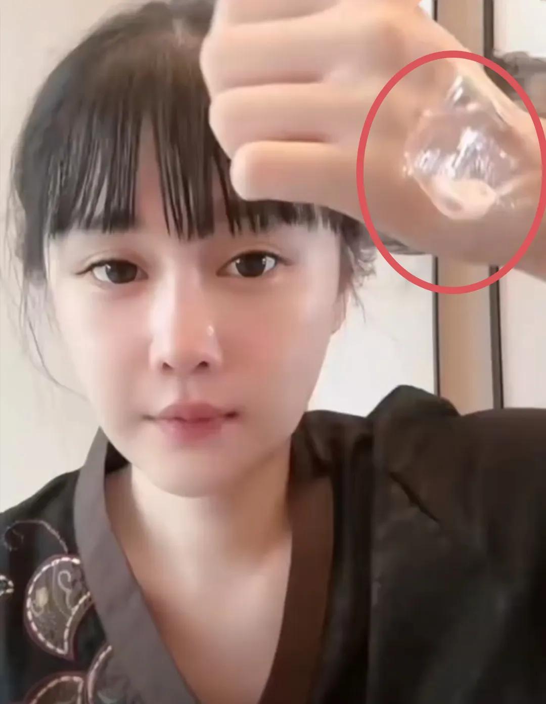 赵本山女儿球球直播透露在治疗抑郁和焦虑症，她的状态看起来非常不好，眼神恍惚，整个