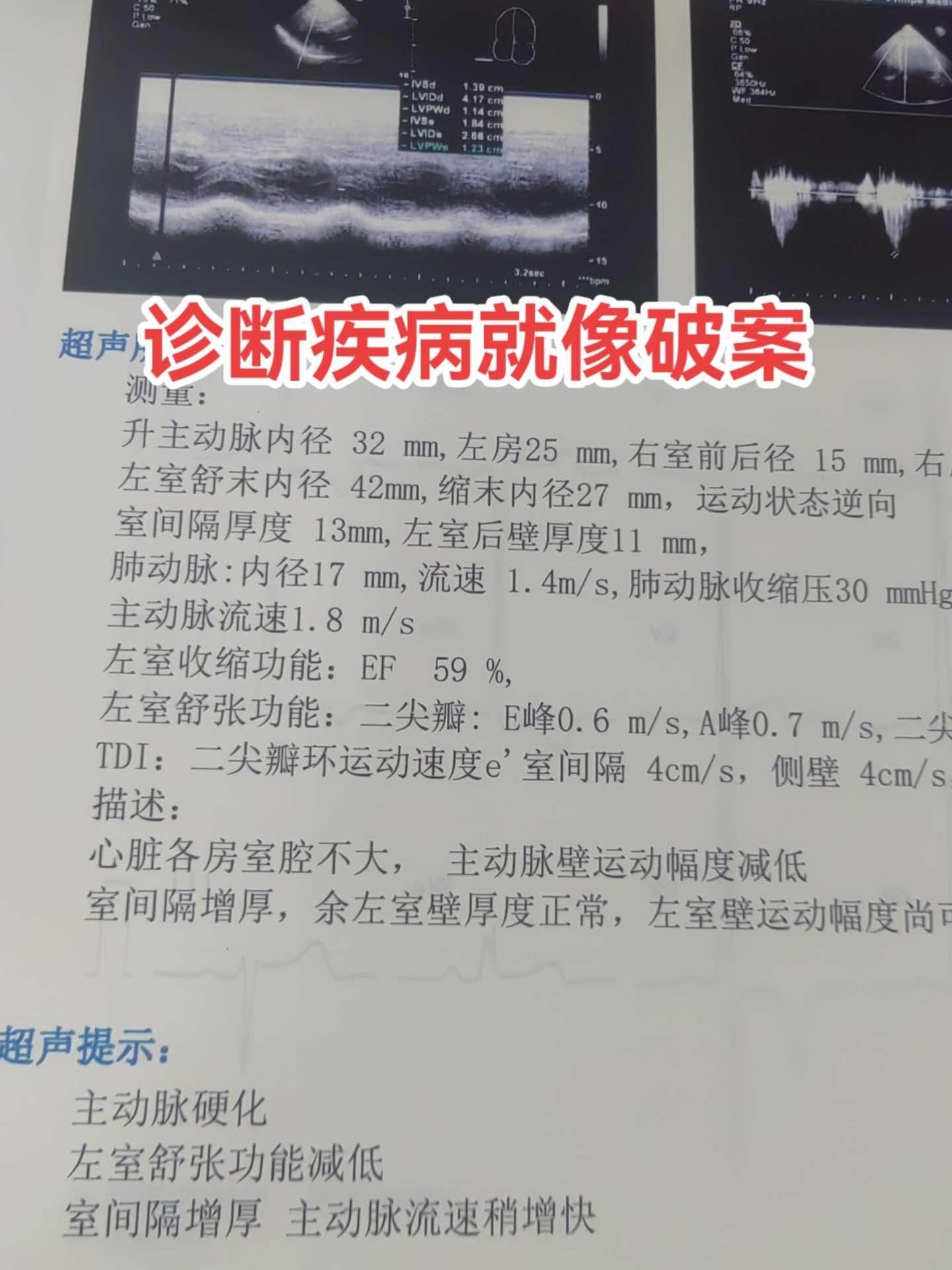 医学科普 医路前行 医学影像 医生日常 超声影像