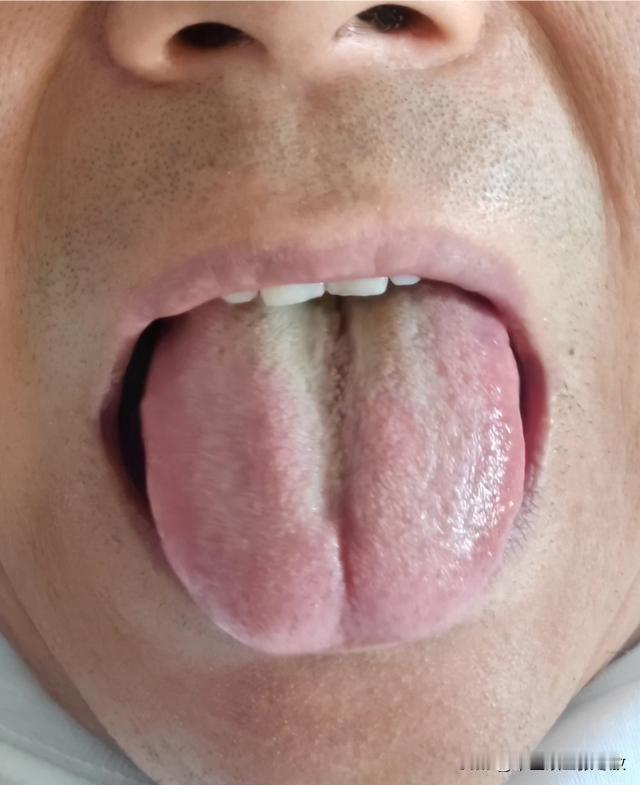 你也别说你时间快了肾虚了，中间这么大个深沟，还是先看看脾吧[撇嘴][撇嘴]
主诉