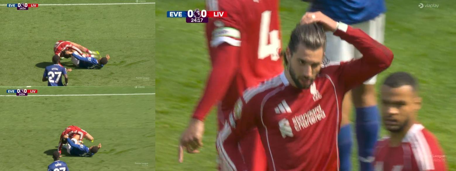 在利物浦和埃弗顿的比赛，索博斯洛伊的头发被拉拽。裁判没有任何表示 