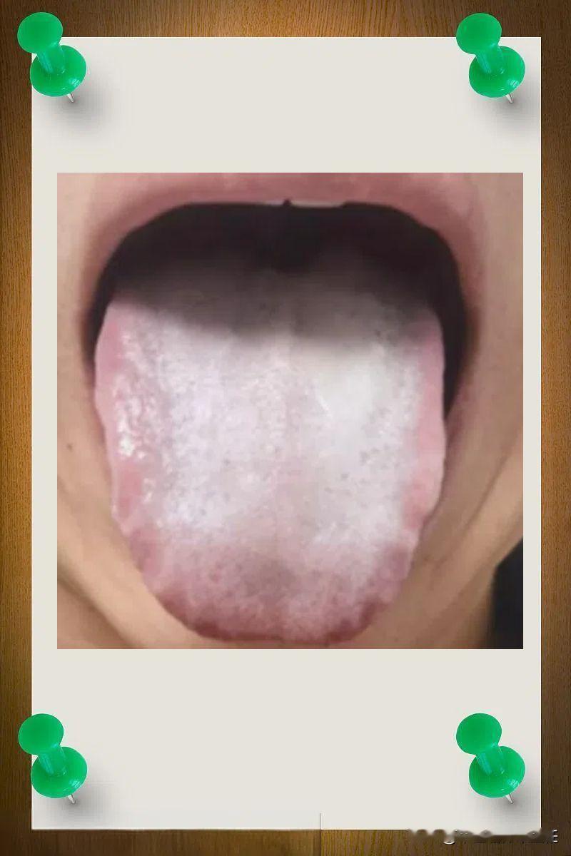 二弟痿软难起？看舌象典型的脾肾阳虚，调理的时候千万不能急！

患者主要问题：宗筋