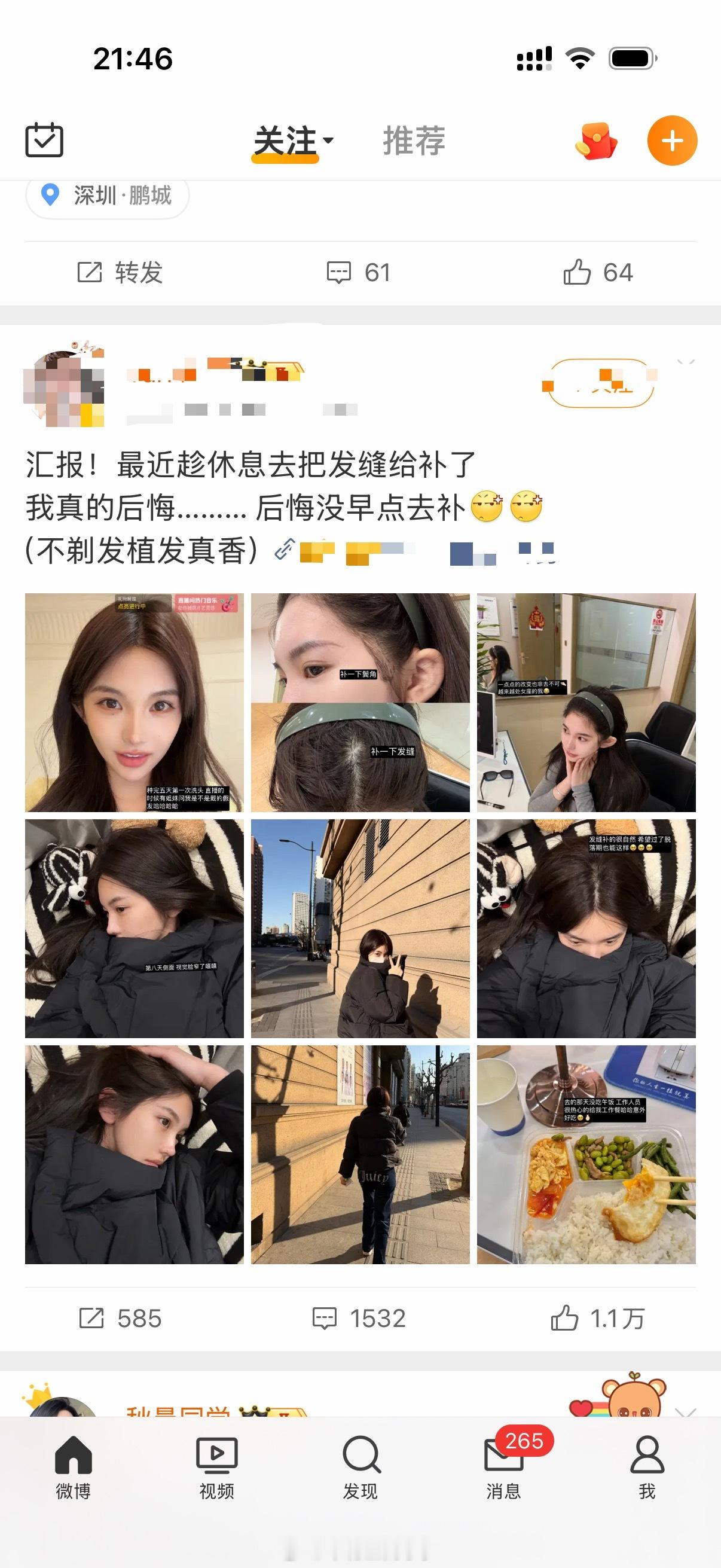 哎呦我滴妈妈呀～前脚刚说了给我推脱发的广子后脚又来了植发[捂嘴哭]是不是看到我图