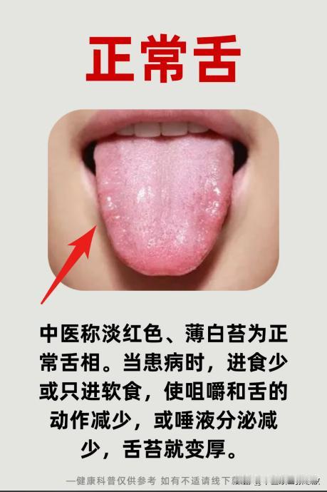 健康舌，裂纹舌，齿痕舌，门诊7大常见舌像一次让你看个够
看不明白发给我，我来帮你
