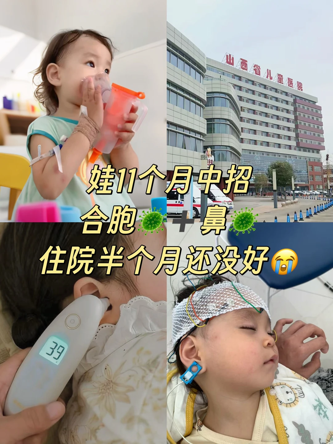11月龄中招合胞+鼻🦠，住院半个月还没好