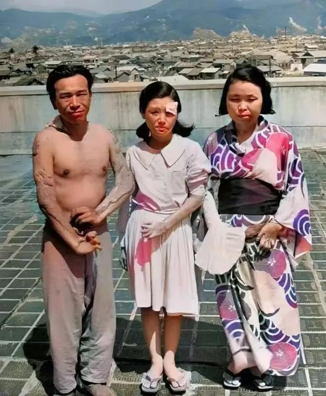 核弹轰炸之后的广岛，幸存的一家三口，肢体和五官都有不同程度的变形。