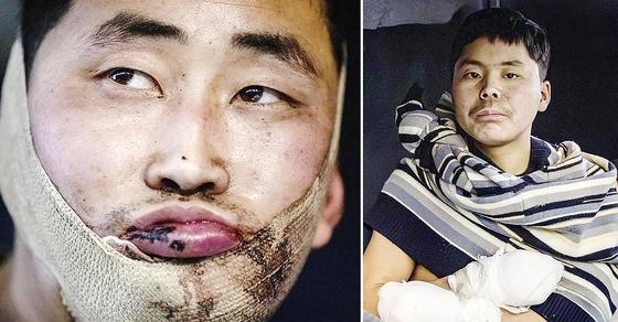 在俄乌战争中被俘的2名朝鲜士兵已被送往韩国。乌克兰总统泽连斯基9月23日在联大发