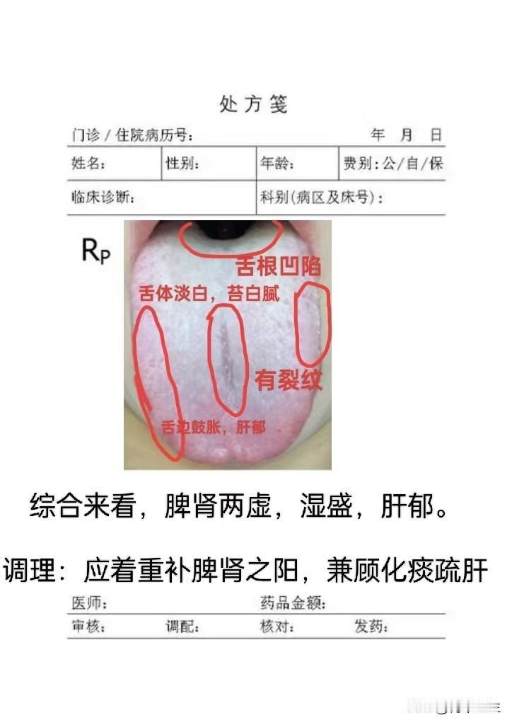 中医公益，挑战一天看60个舌象，有问题，尽管过来，全天在线回复！

拍照的时候需
