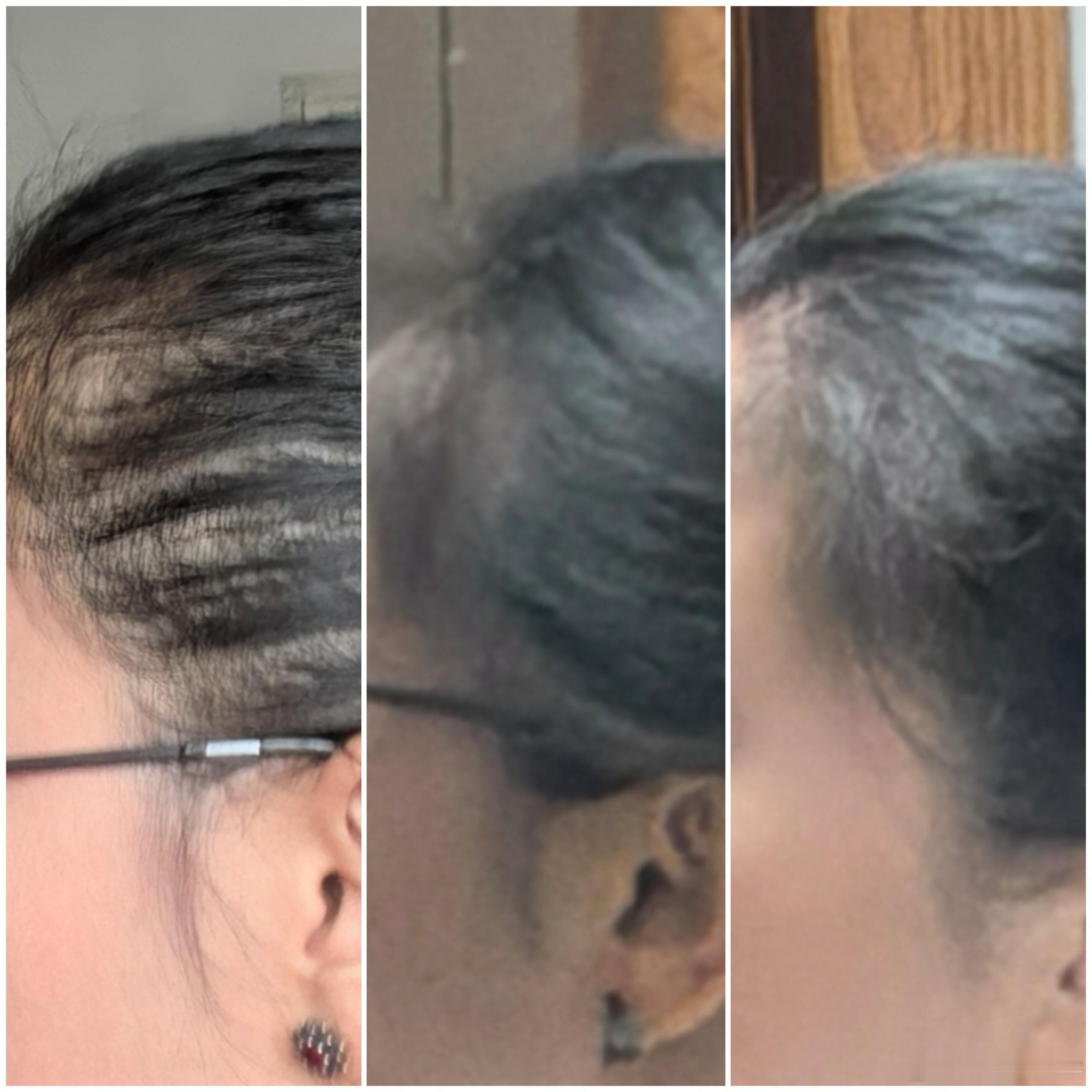 删照片，翻到2025年9月的，好秃……那时候真的没辙了，后面两张是最近的，就是多