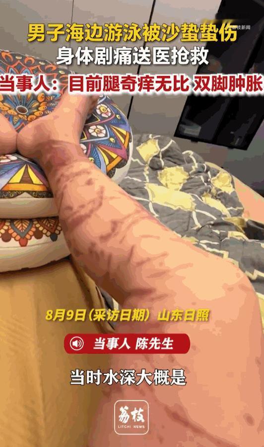 万万没想到！山东日照，男子下海游泳，谁能想到在浅水区突然遭遇了水下“隐形杀手”，