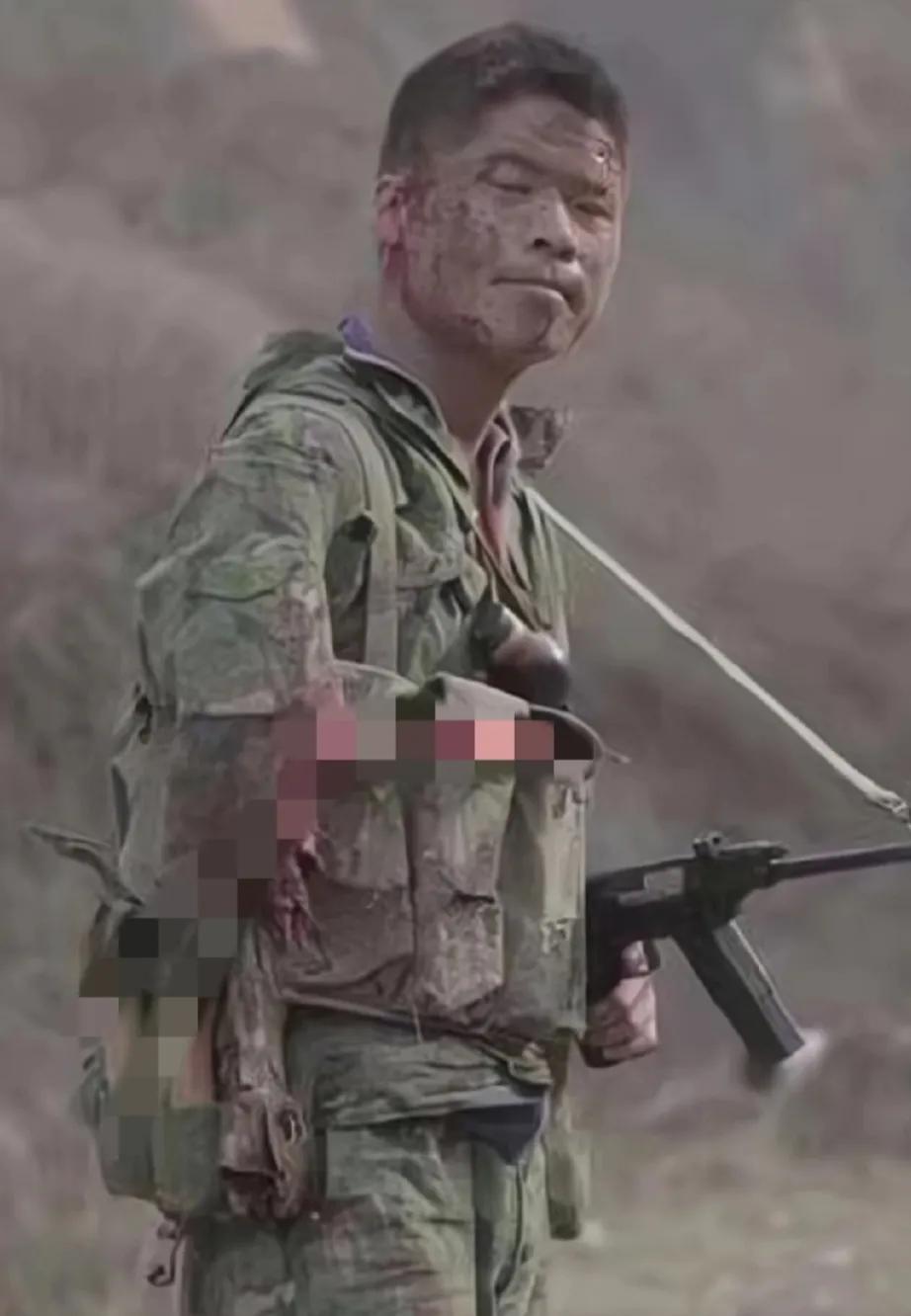 这是战场最真实的一幕！
一名士兵被炮弹炸断一只手臂，他满身血污，单手持冲锋枪，倔