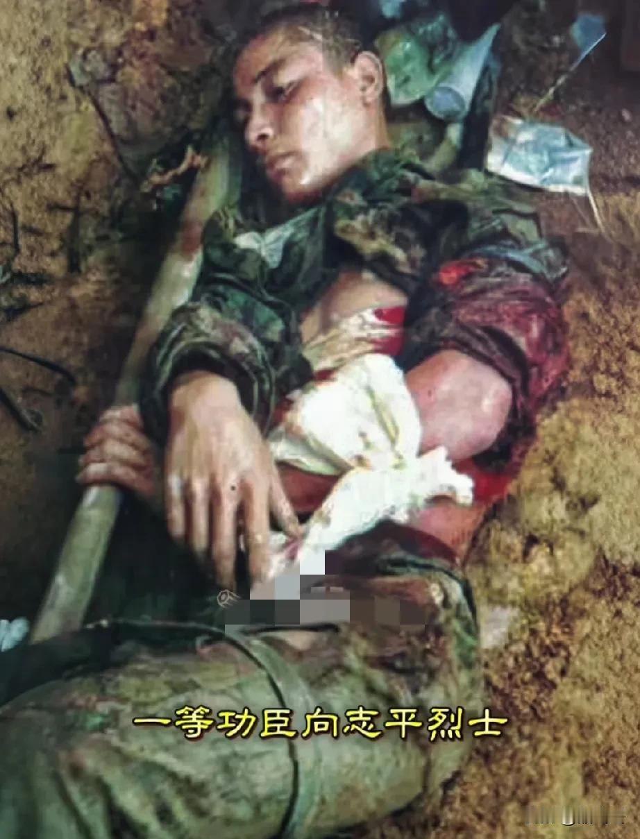 这是一等功臣向志平烈士的遗体，他牺牲时才20岁，风华正茂！
1984年，攻打老山