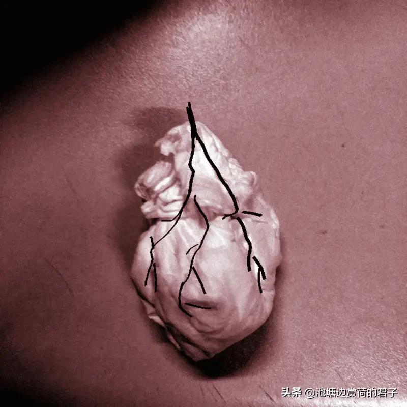 男子心脏烂洞命悬一线 妻子怀孕6个月 男子心脏烂洞命悬一线，而妻子还怀孕6个月，