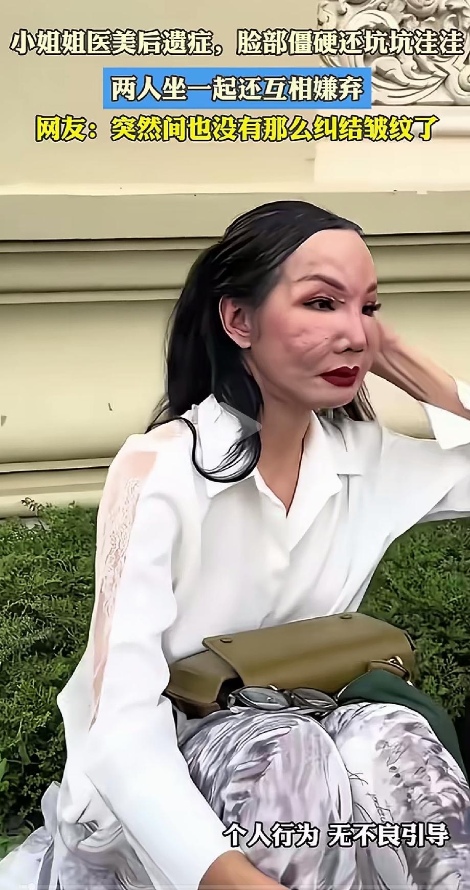 女人为了爱美，把自己脸折腾的失去了本来面目，，脸部浮肿，坑坑洼洼的，有种怪兽的即