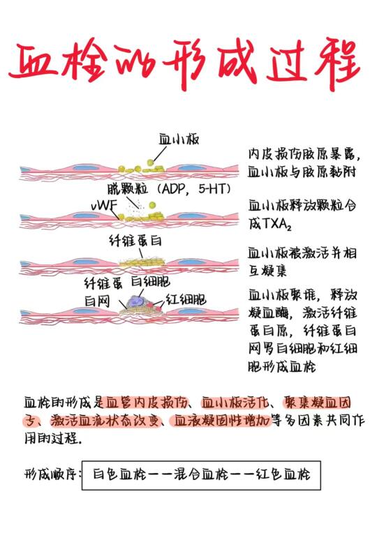 医学生笔记——血栓