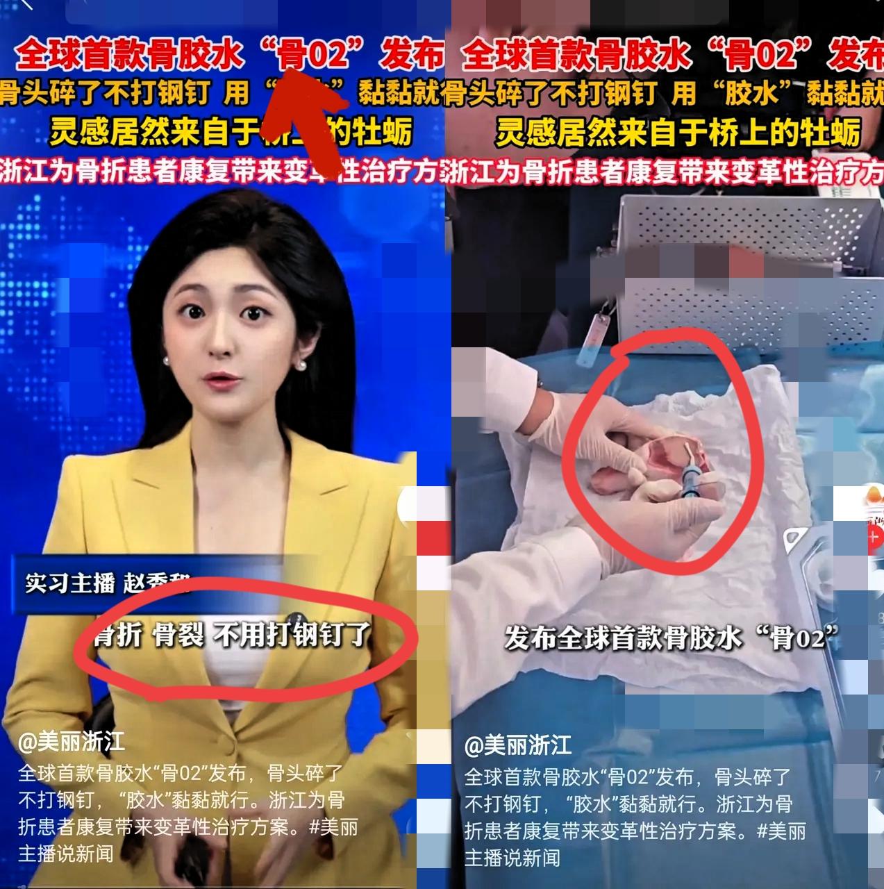 这下出名了，
不仅中国，连全世界都要知道了。
万万没想到，浙江邵逸夫医院研发出了