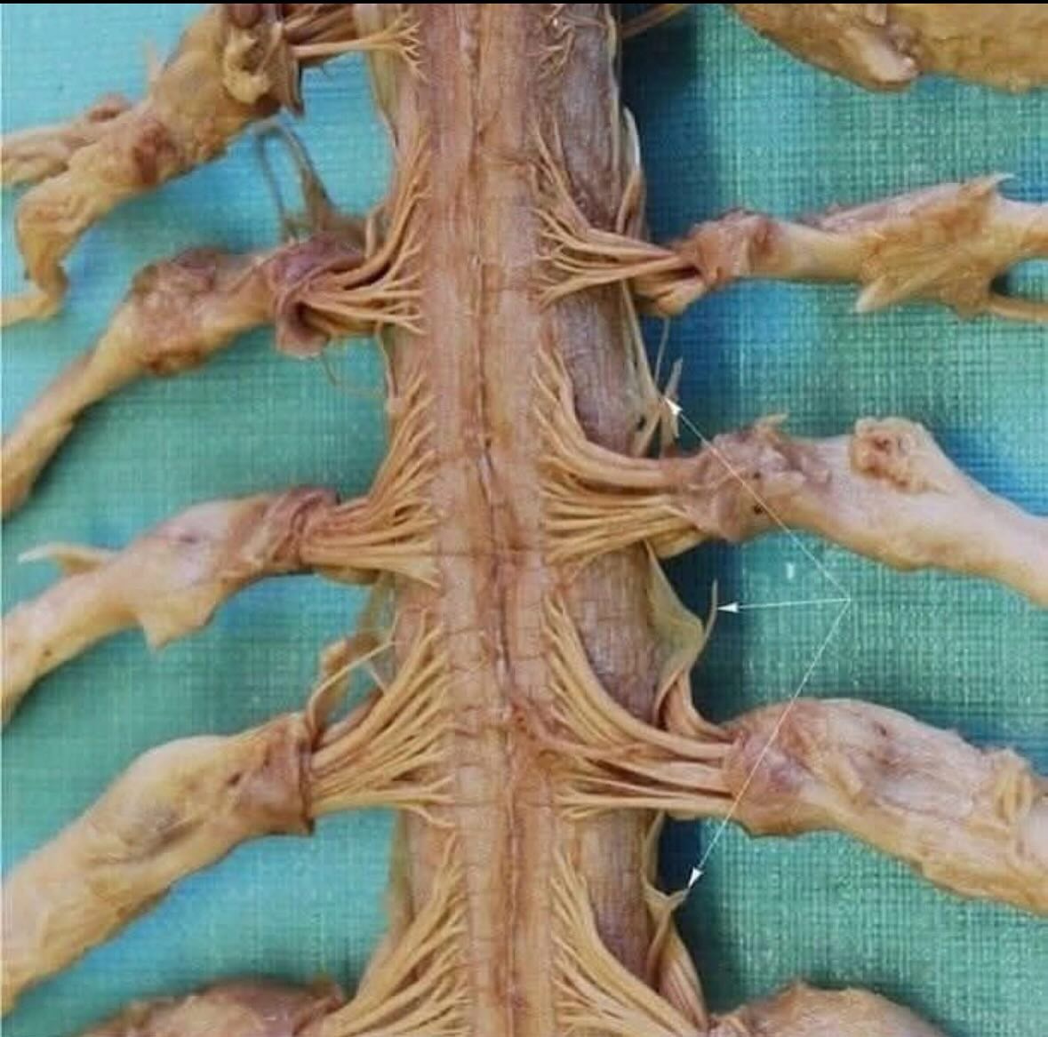 运动康复 之前和大家讲康复中的神经控制和激活，翻阅到一张图，分享给你们。每次我看
