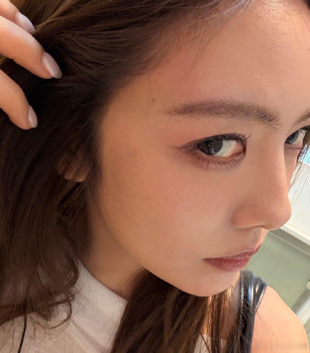 【蔡文静下楼不看路磕到头】蔡文静磕到头了 5月28日，蔡文静在社媒发文：“我下楼