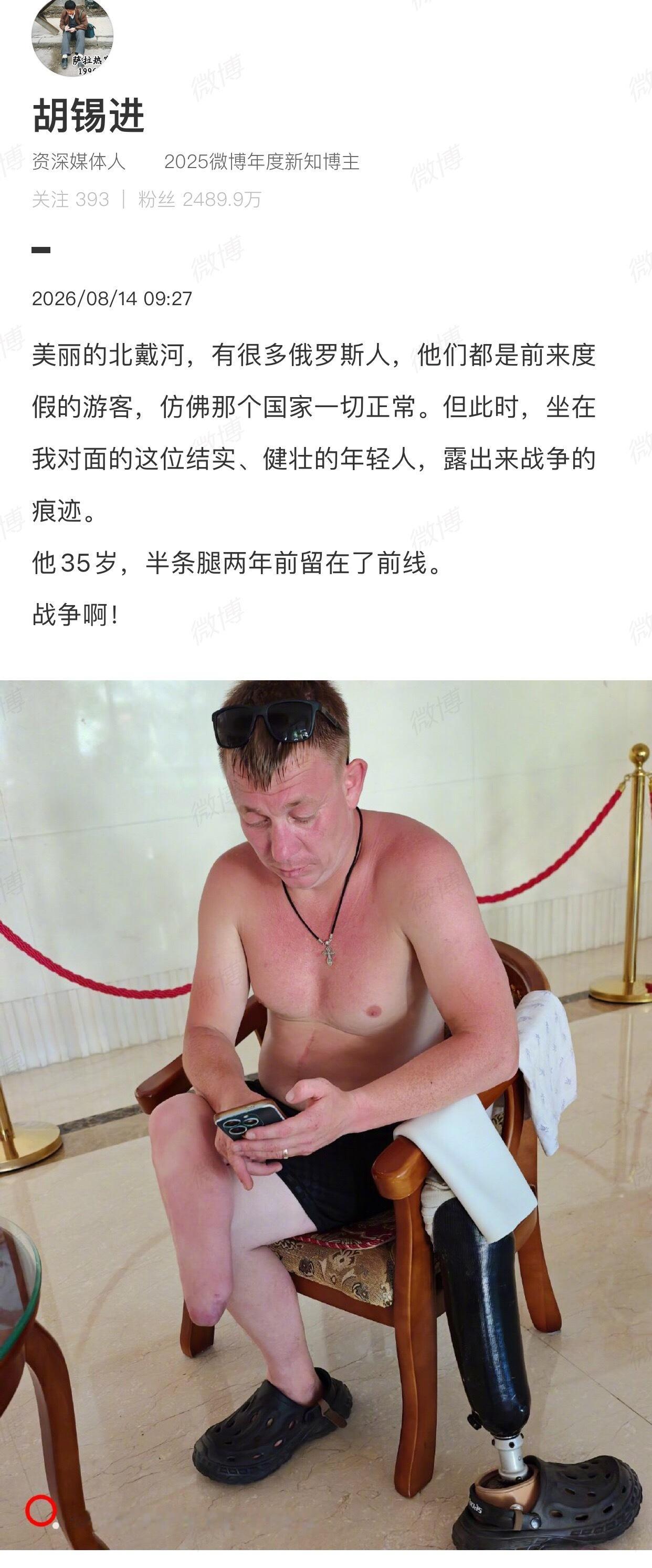 更正为：他35岁， 半条腿两年前留在了乌克兰。 