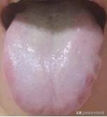 总是力不从心、干着急？金匮肾气丸别乱用！温中散寒才是真突破口
 
大家好，我是中