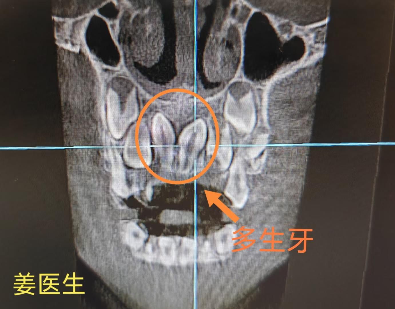 若是牙生百无常 观风 观雨 观花黄