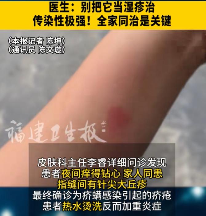 太吓人了！7月16日报道，福建李先生去朋友家住了几天，回来后肚子和大腿根起了红疹