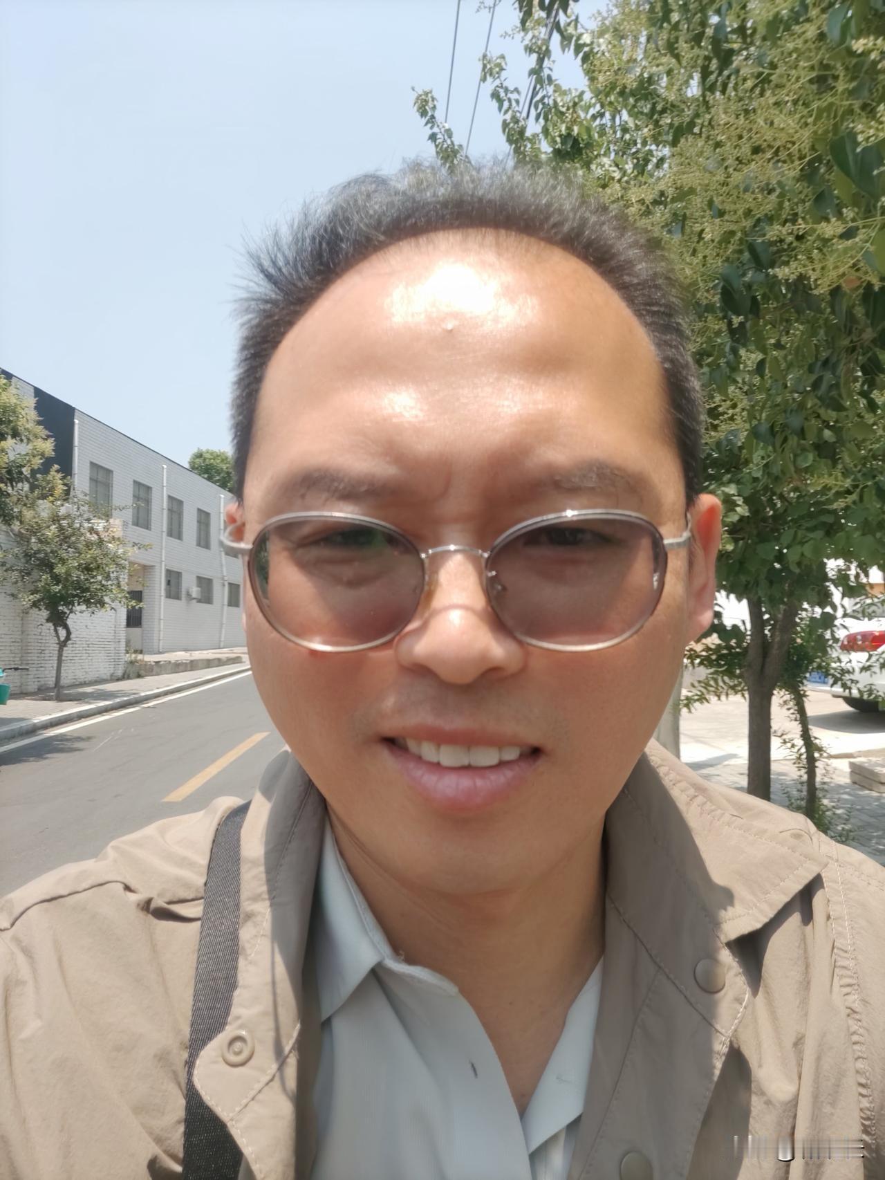 掉头发最严重的时候是上高中，那个时候回宿舍洗头一掉一大把，为了帅气还留着稍微长一