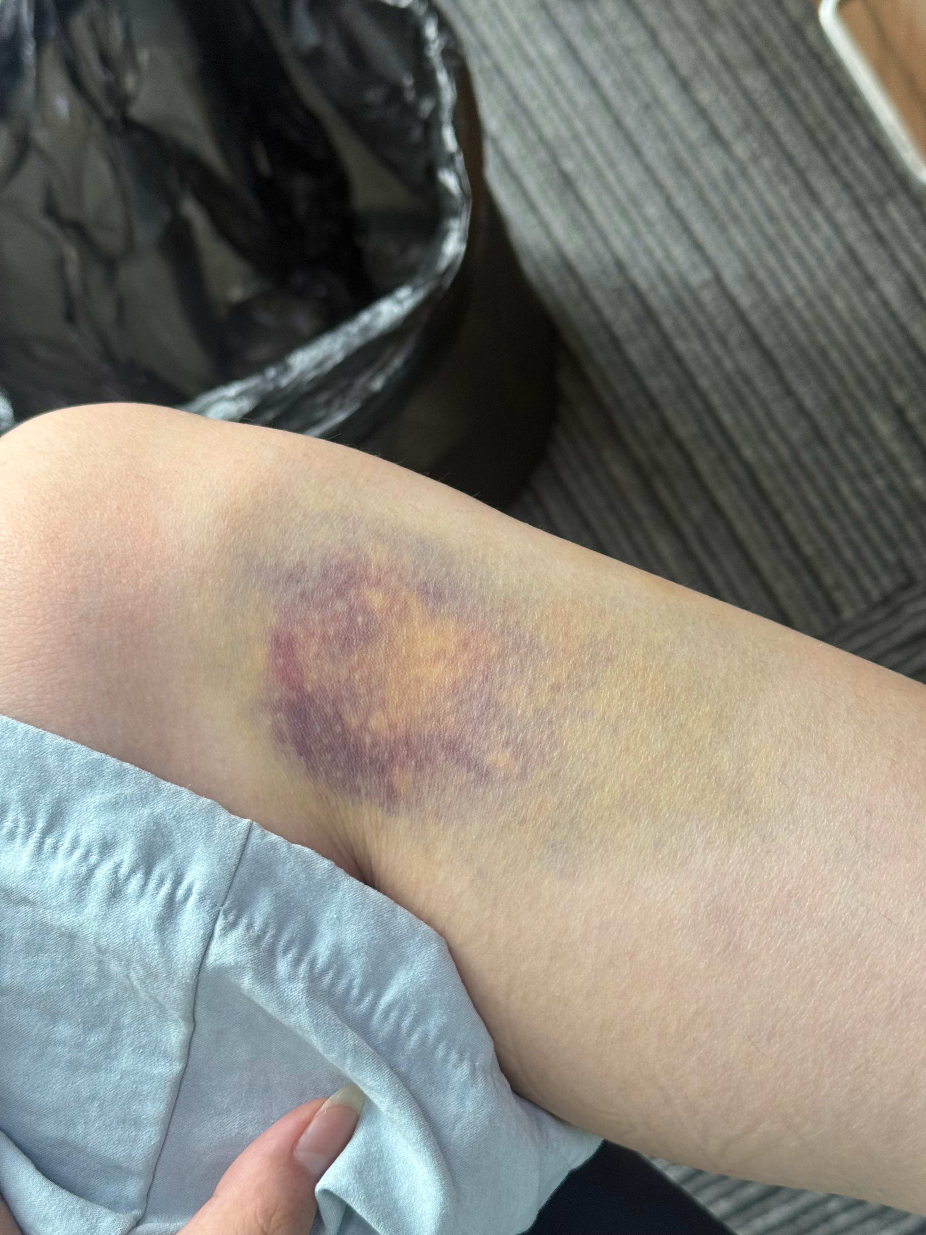 有人问你吃不吃 有人直接给你买