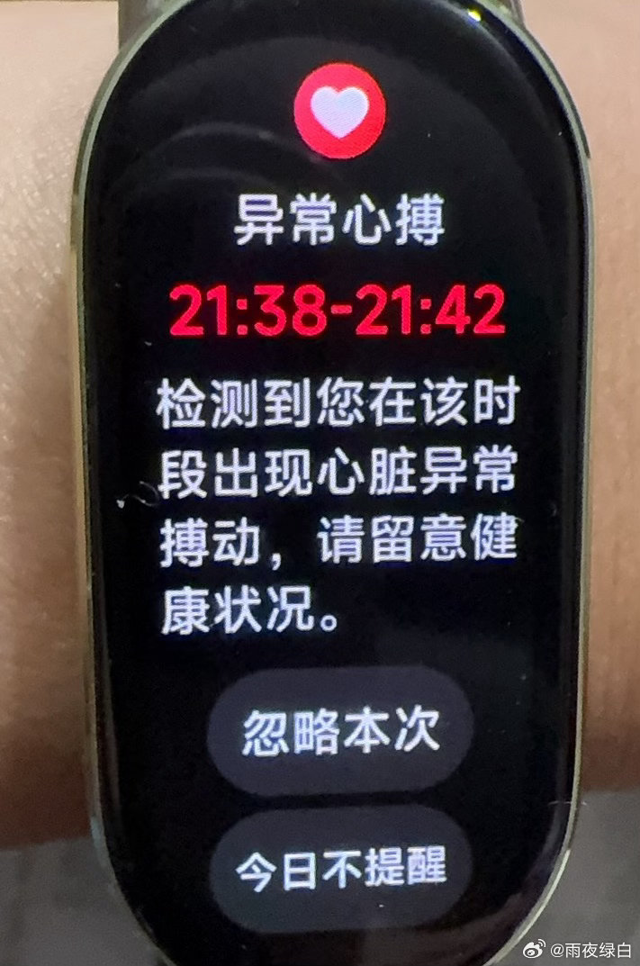 额 打第五人格打出异常心搏了 