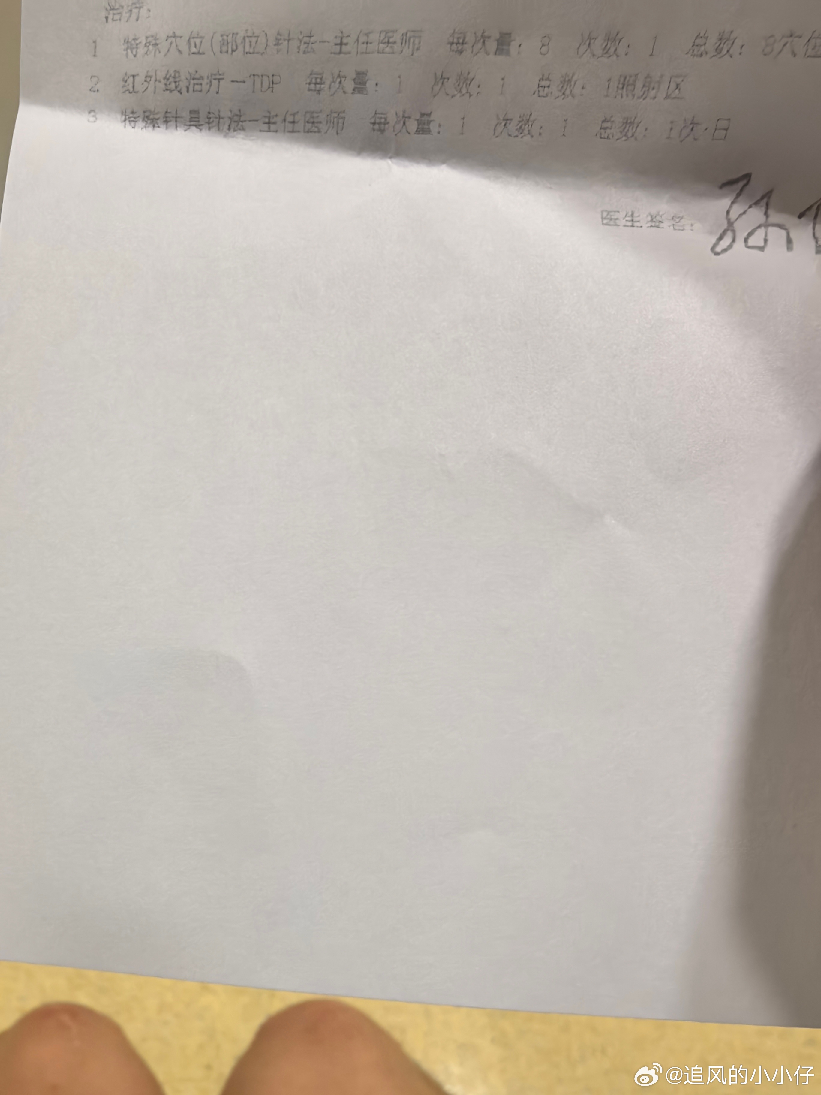 扎针了。。。灸一灸。省中医还是很牛的。 