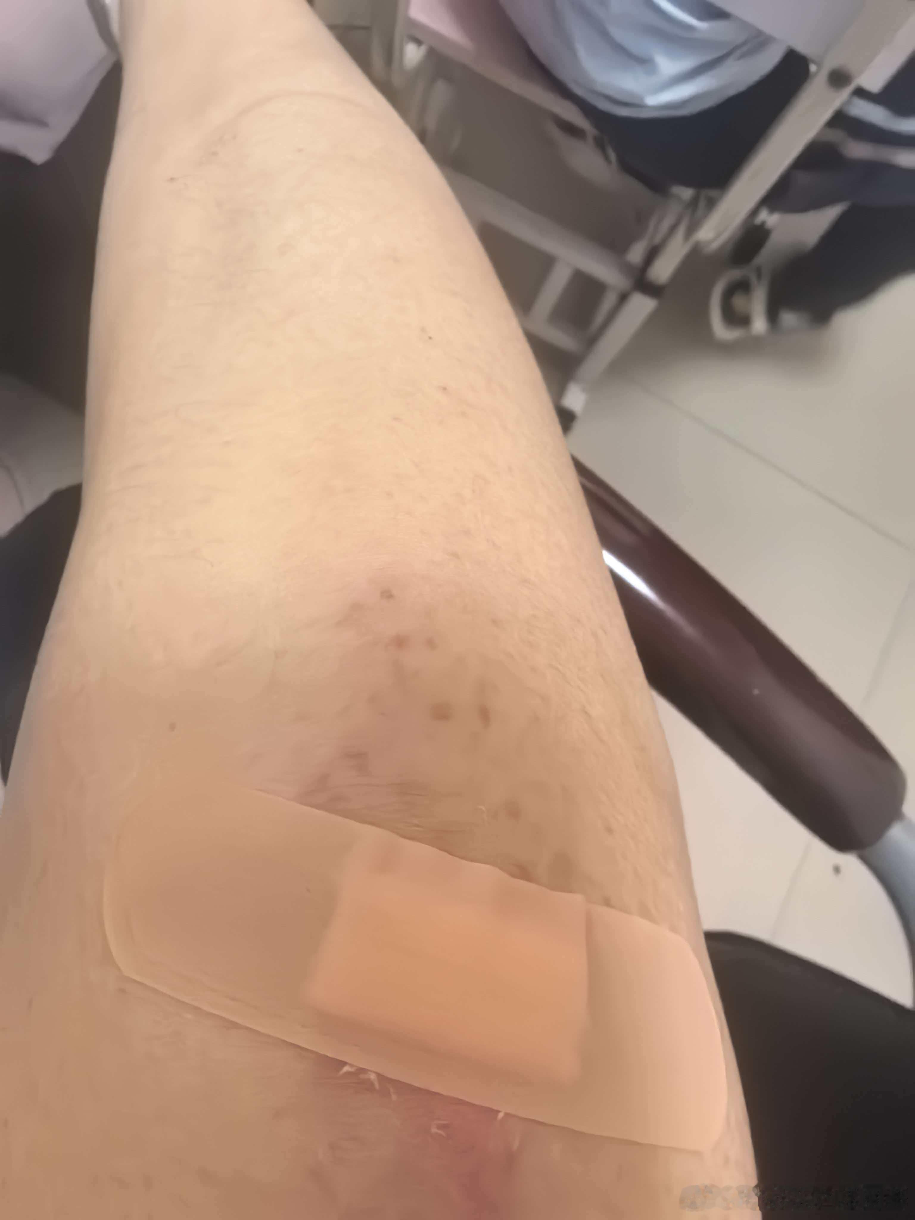 今天中午收了盘，我就骑着电车去送外卖 走在路上看到一块地方比较脏，我想越过去就偏