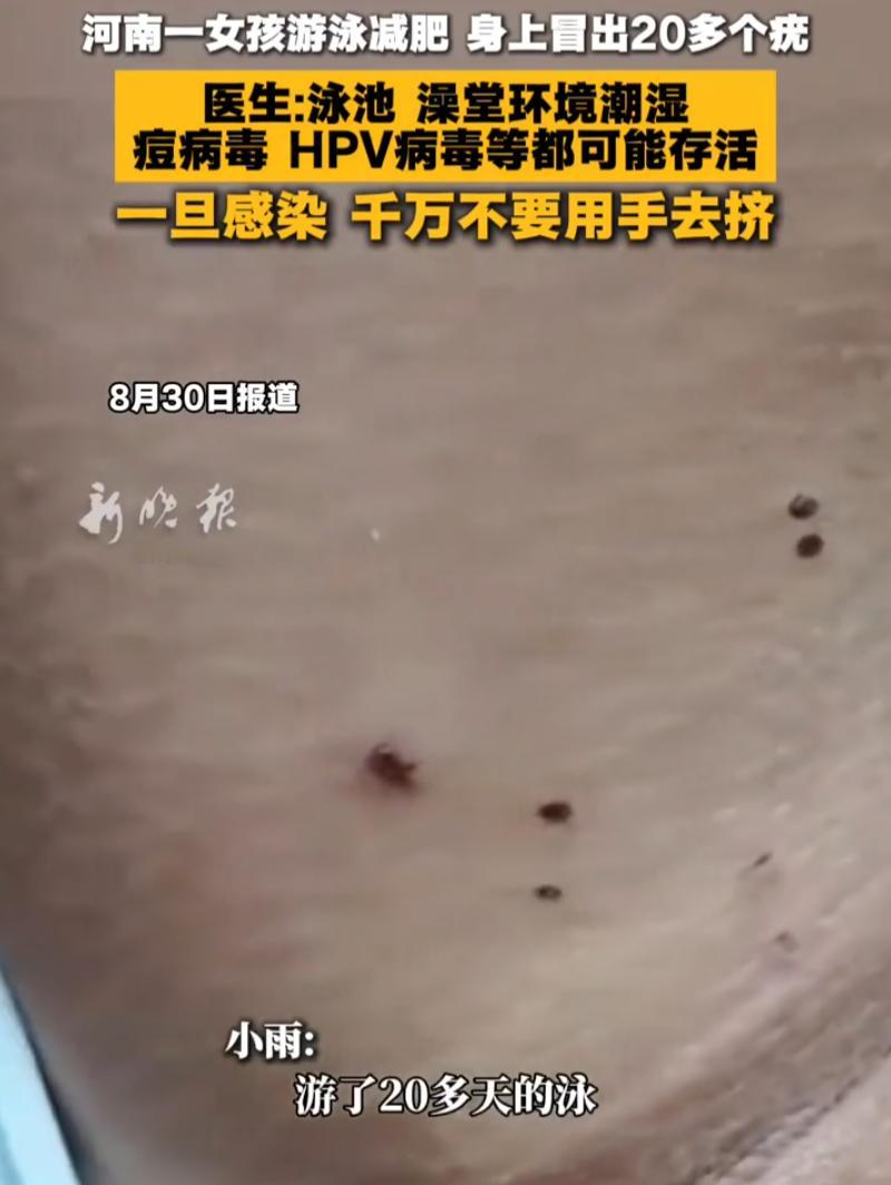 河南，一女孩假期想要游泳减肥，在泳游馆里泡了20多天，体重确实有变化，可身上却冒