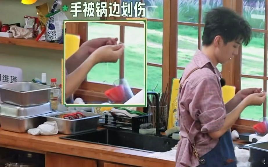 王俊凯怕姜妍内疚说没划伤王俊凯手指上好多创可贴后来我们看到创可贴，才补上那一秒的