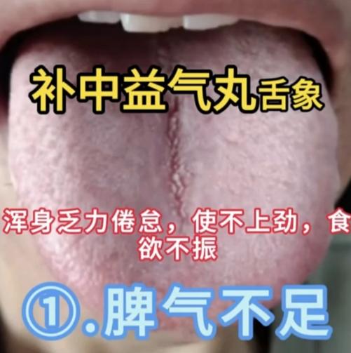 脾胃虚不虚，舌头一伸就知道！5种脾虚舌象+对应调理方，别再瞎补了！
3月看舌第一