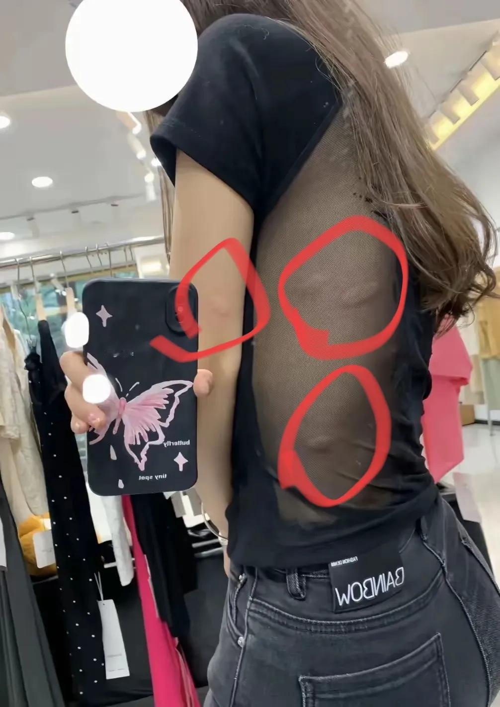 美女这身上大概率是过敏了吧？有懂的吗，到底怎么回事？？！！