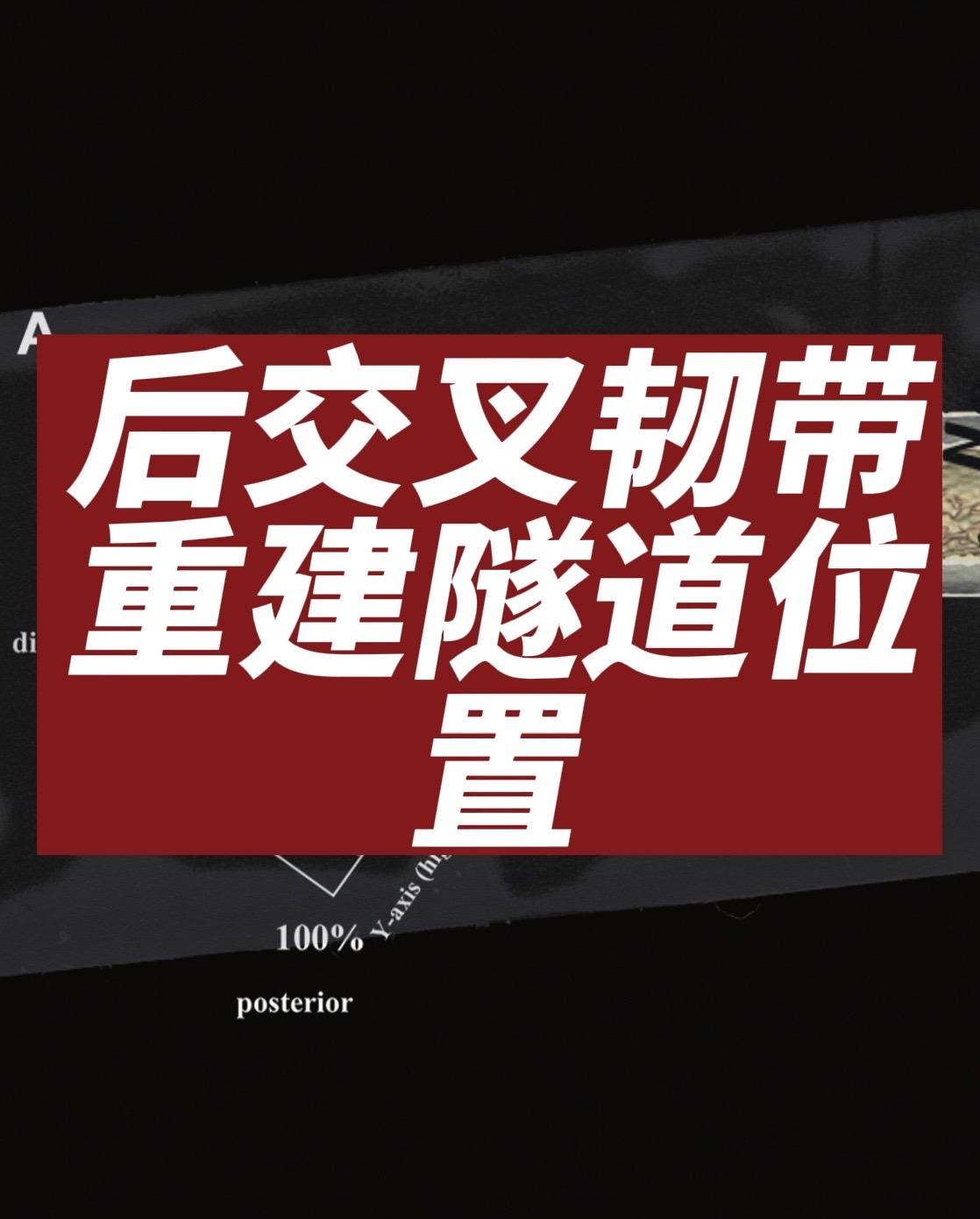 后交叉韧带重建。后交叉韧带（PCL）重建手术中，适当的隧道位置、隧道角...